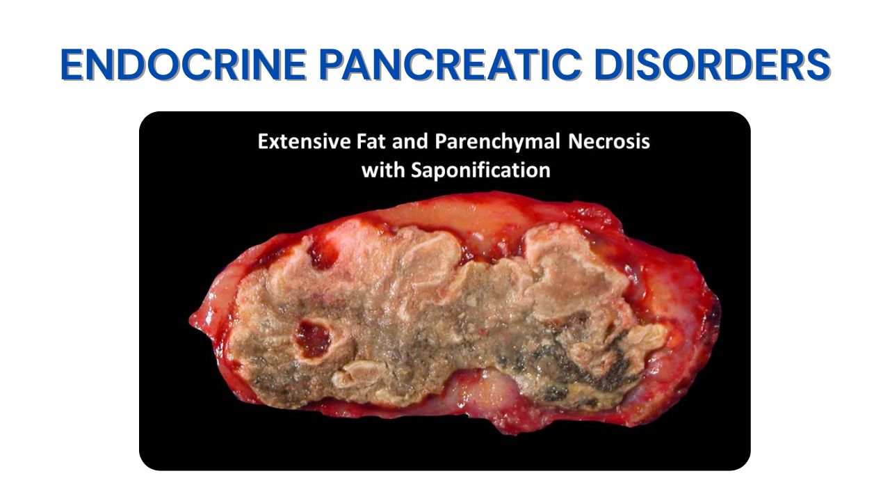Endocrine Pancreatic Disorders (2)