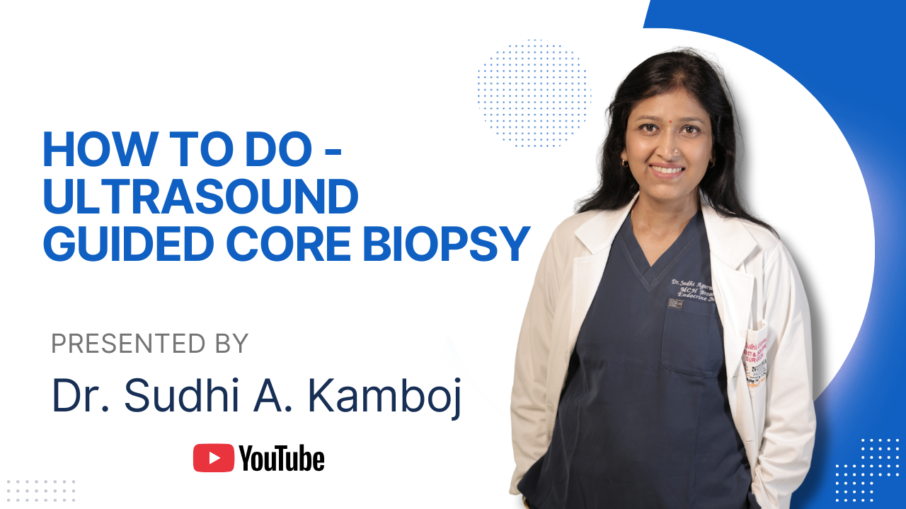 HOW TO DO ULTRASOUND GUIDED CORE BIOPSY