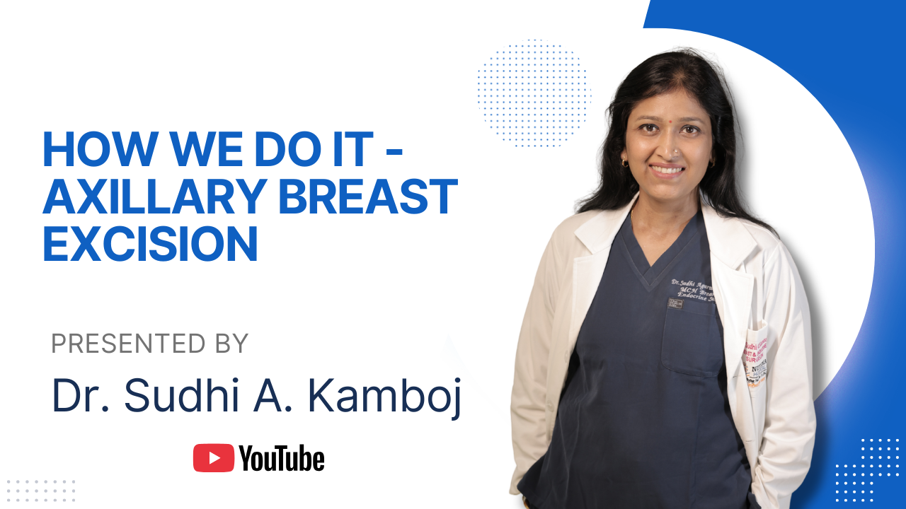 HOW WE DO IT AXILLARY BREAST EXCISION