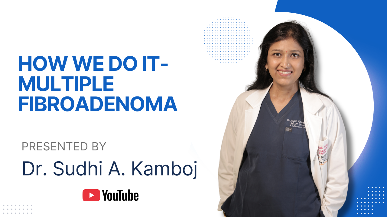 HOW WE DO IT MULTIPLE FIBROADENO