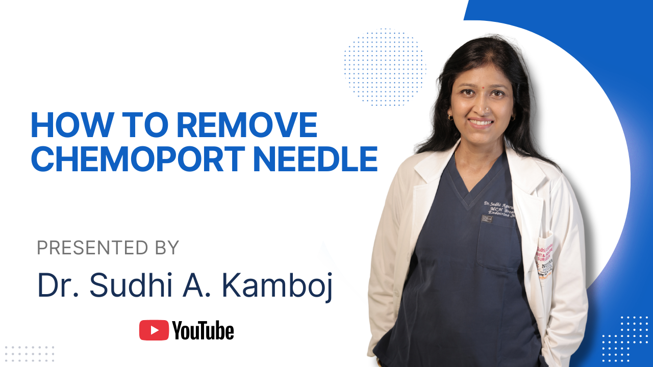 How To Remove Chemoport Needle